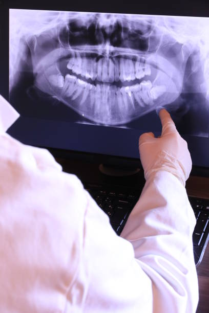 Best Chipped Tooth Repair Near Me  in Sterling, VA