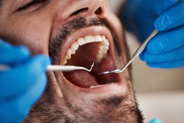 Best Cracked Tooth Emergency Dentist  in Sterling, VA