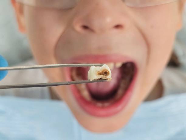 Best Dentist for Dental Trauma  in Sterling, VA